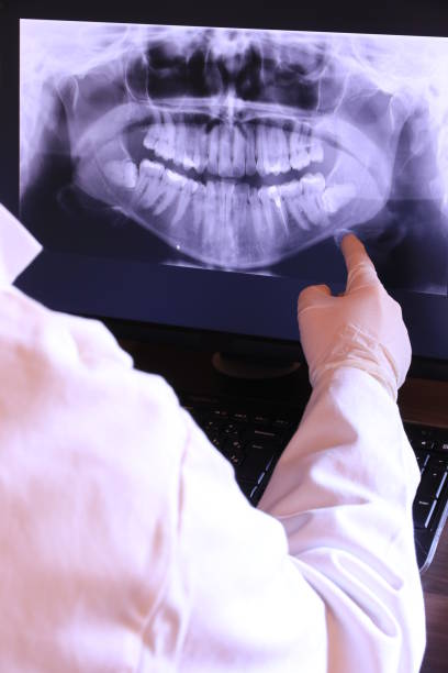 Best Emergency Root Canal Treatment in Minco, OK