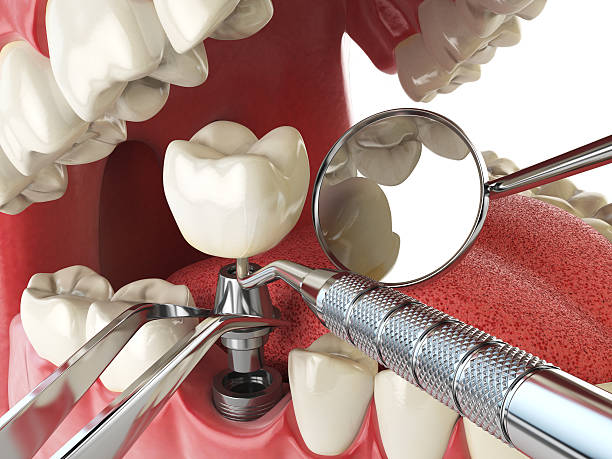 Best Broken or Cracked Tooth Emergency Dentist in Minco, OK